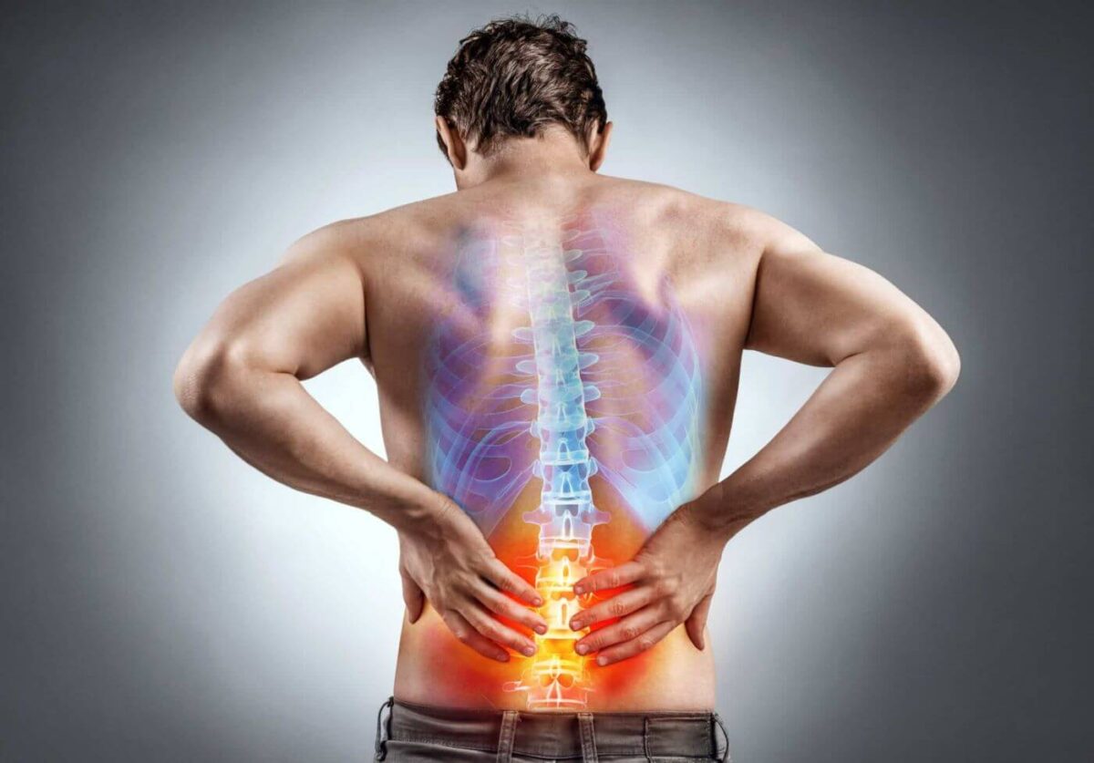 Spondylosis