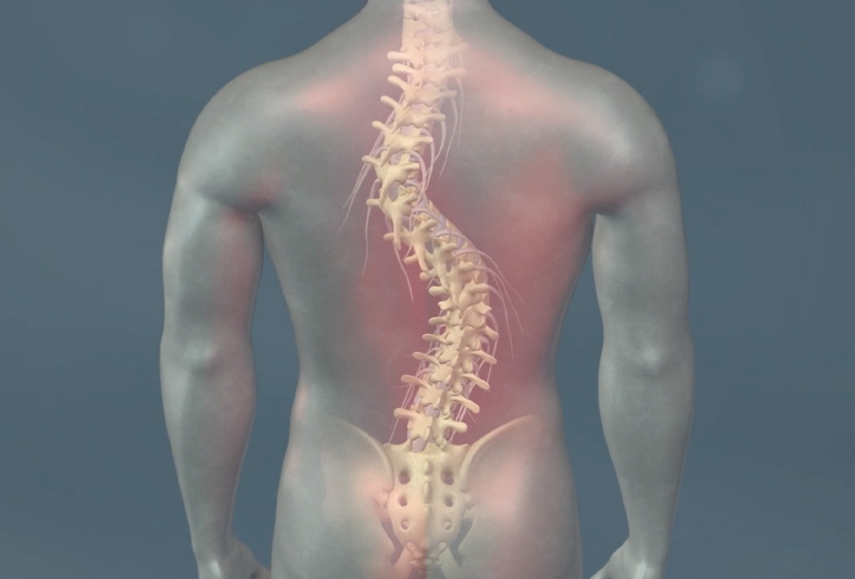 3D mad with curved spine